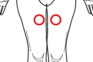 Patologie Del Muscolo Quadricipite