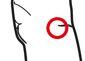 Patologie Del Legamento Collaterale Mediale
