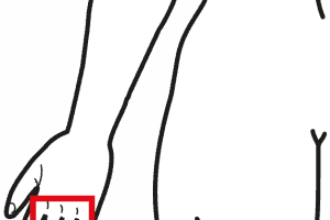 Dolori Alle Dita