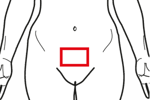 Dolori Mestruali