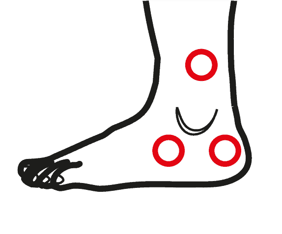 Patologie Caviglie